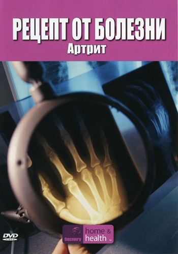 Discovery: Рецепт от болезни: Артрит / Discovery: The Body Invaders: Arthritis (2001)